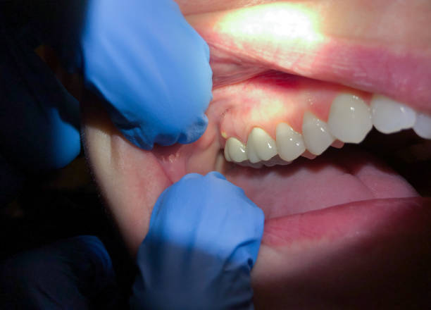 Best Emergency Treatment for Jaw Pain or Injury in Smethport, PA