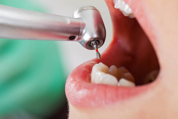 Best Emergency Dental Care for Sports Injuries in Smethport, PA